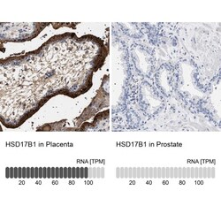 17 beta-HSD1/HSD17B1 Antibody, Novus Biologicals 0.1mL; Unlabeled:Antibodies,